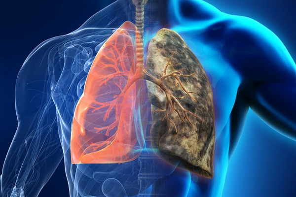 Эксперт FCI: вейпинг может вызвать новую волну рака