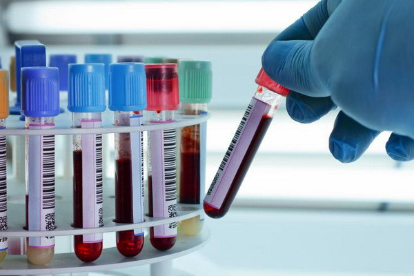 WADA highly appreciated the work of the anti-doping agency of Uzbekistan